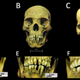 Skulls and dental decoration patterns observed on the skeletal remains.
